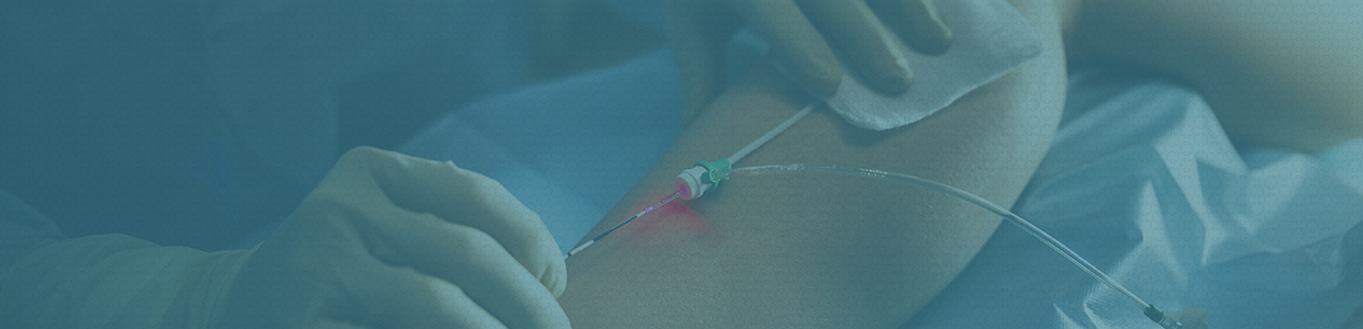 Imagem Cirurgia Vascular